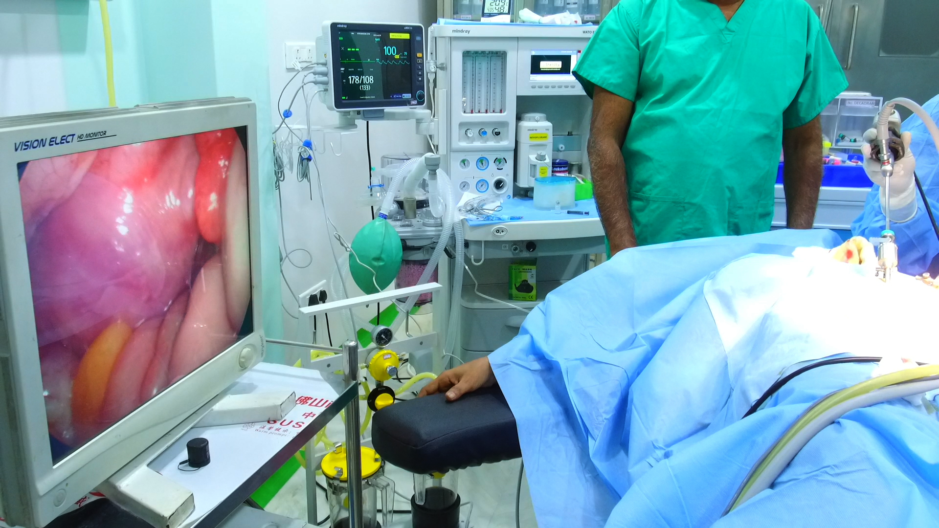 Laparoscopic Surgery